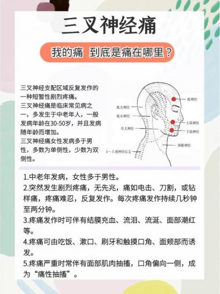 三叉神经痛有什么表现