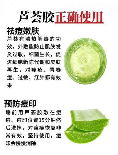 抹芦荟胶能去掉脸上的痘痘么?有人说有用,有人说不好