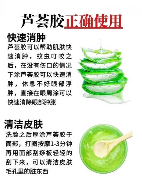 芦荟胶祛痘效果好吗